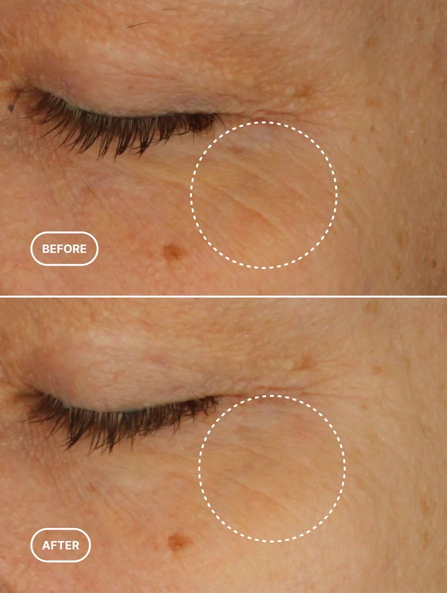 Eye Level — Retinol Alternative Eye Serum