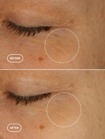Eye Level — Retinol Alternative Eye Serum