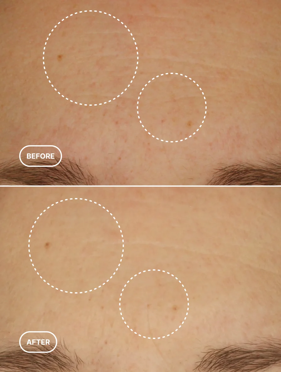 Long Game — Retinol Alternative Serum