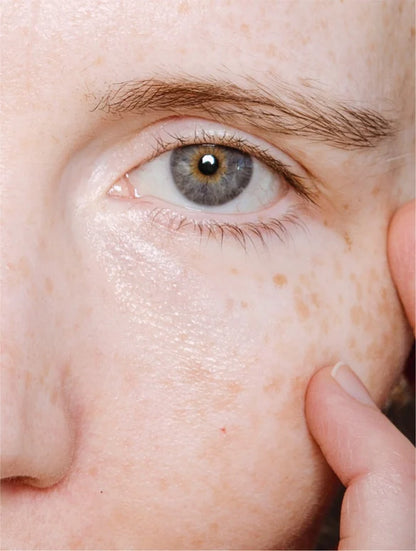 Eye Level — Retinol Alternative Eye Serum